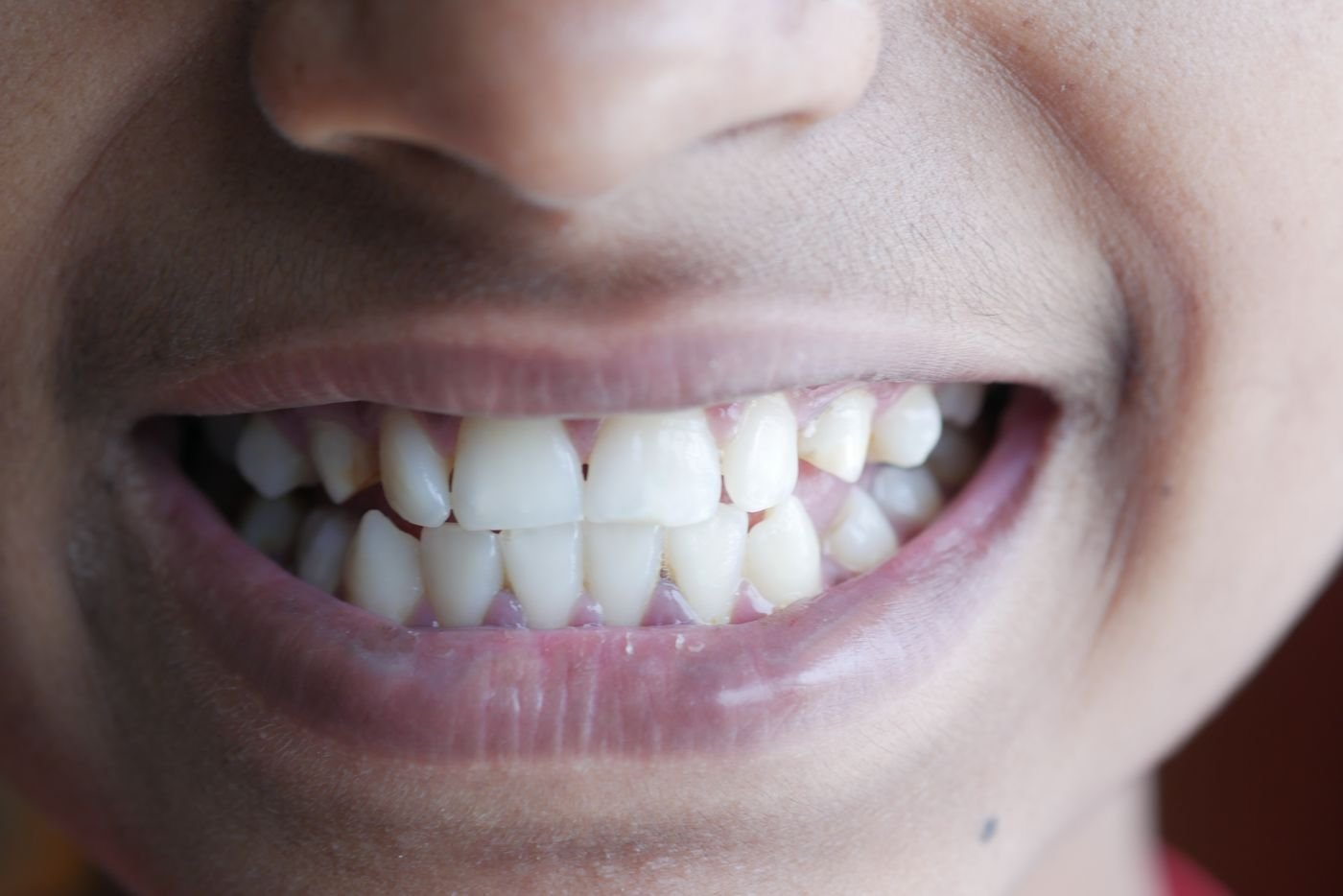 Shërbime dentare